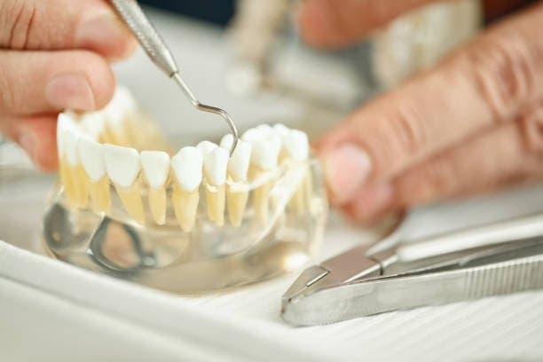 Dental Crowns and Dental Bridges: Restoring Function and Beauty to Your Smile